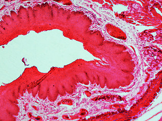 Image showing Epithelium micrograph