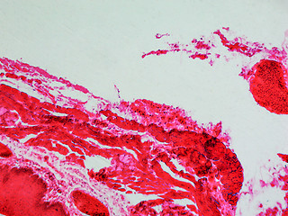 Image showing Epithelium micrograph