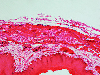 Image showing Epithelium micrograph