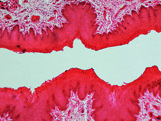 Image showing Epithelium micrograph