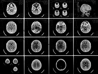 Image showing Glowing and radiant MRI scan