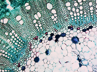 Image showing Cotton stem micrograph