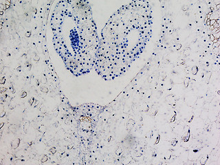 Image showing Lily ovary micrograph