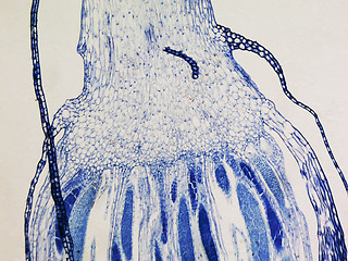 Image showing Moss protonemata micrograph