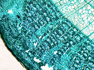 Image showing Tilia stem micrograph