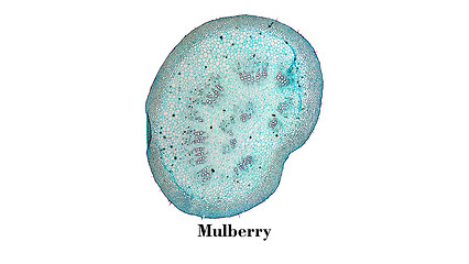 Image showing Mulberry micrograph