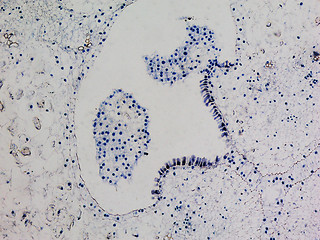 Image showing Lily ovary micrograph