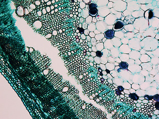 Image showing Cotton stem micrograph