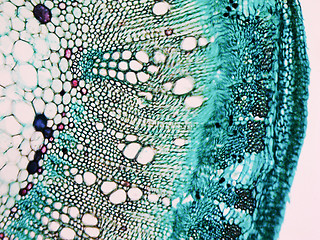 Image showing Cotton stem micrograph