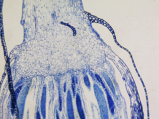 Image showing Moss protonemata micrograph