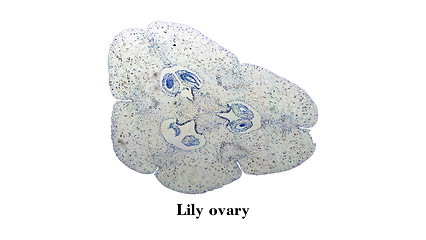 Image showing Lily ovary micrograph