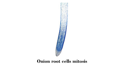 Image showing Cells mitosis micrograph