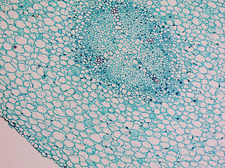 Image showing Vicia faba root micrograph