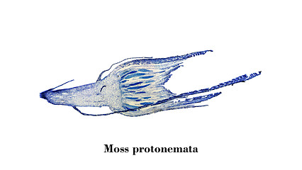 Image showing Moss protonemata micrograph