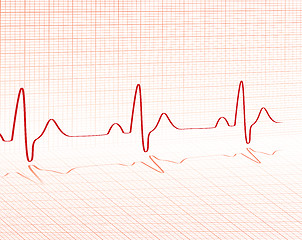 Image showing heart beat red grid