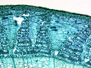 Image showing Tilia stem micrograph