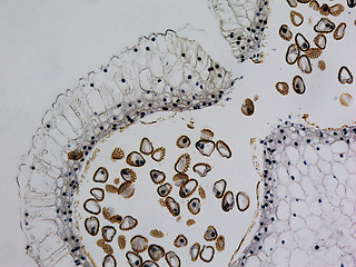 Image showing Lily anther micrograph