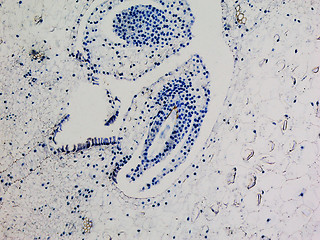 Image showing Lily ovary micrograph