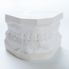 Image showing Gypsum model of human jaw on a white background.