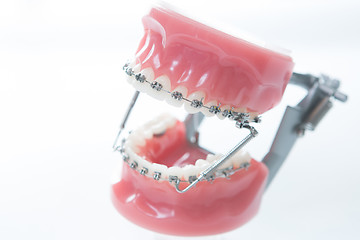 Image showing Dental lower jaw bracket braces model on white