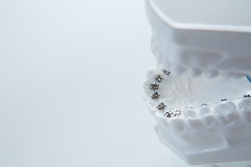 Image showing Dental lower jaw bracket braces model on white