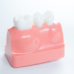 Image showing Close up of a Dental  implant model. 
