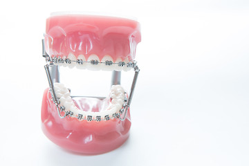 Image showing Dental lower jaw bracket braces model on white