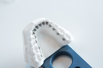 Image showing Dental lower jaw bracket braces model on white