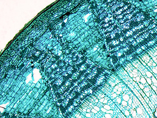 Image showing Tilia stem micrograph