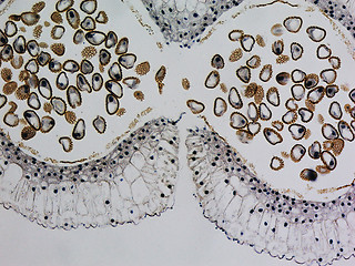 Image showing Lily anther micrograph