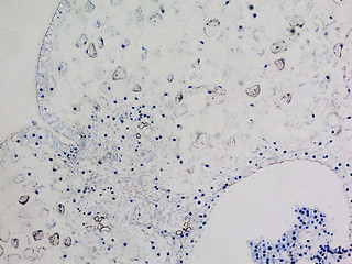 Image showing Lily ovary micrograph