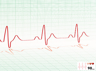 Image showing heart beat green grid