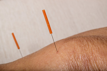 Image showing acupuncture treatment on leg