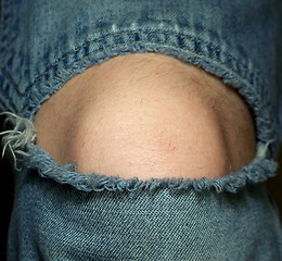 Image showing Knee in Jeans