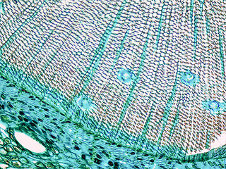 Image showing Pine Wood micrograph