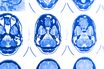 Image showing CT and MRI of the skull