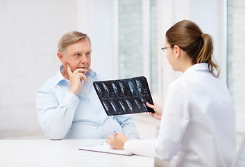 Image showing female doctor with old man looking at x-ray