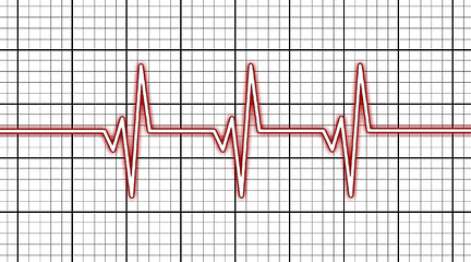 Image showing Electrocardiogram - Concept of healthcare