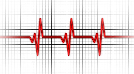 Image showing Electrocardiogram - Concept of healthcare