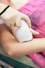 Image showing photo epilation