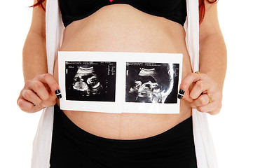 Image showing Pregnant women with ultrasound picture.