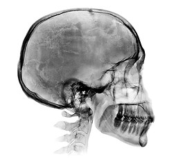 Image showing Detailed Human skull X-ray image