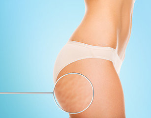 Image showing close up of woman buttocks with cellulite