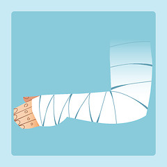 Image showing Bandaged hand after fracture or injury