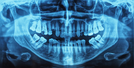 Image showing Medical Xray