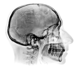 Image showing Detailed Human skull X-ray image