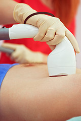 Image showing male laser epilation