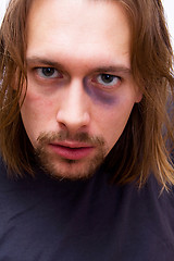 Image showing Young man with black eye