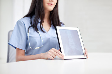 Image showing close up of doctor showing x-ray on tablet pc