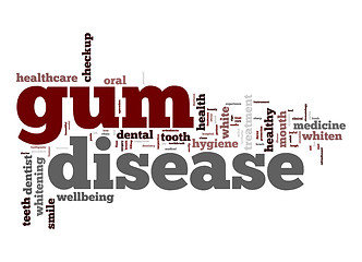 Image showing Gum disease word cloud